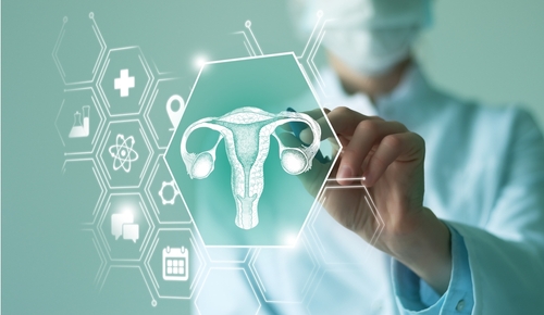 Blood-Based Screening Model Effectively Detects Ovarian Cancer