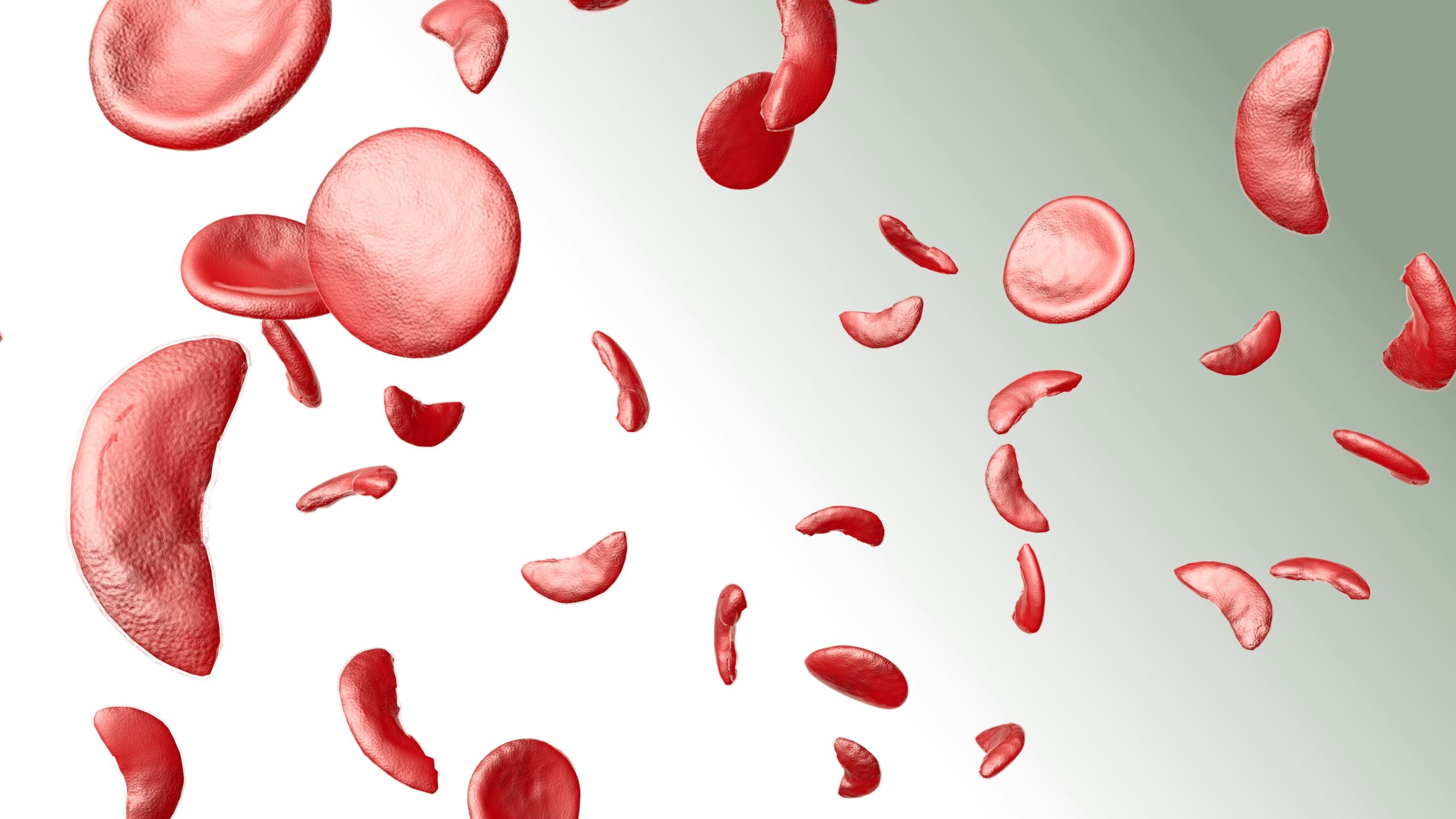 Oral Etavopivat Is Effective for Sickle Cell Disease Treatment in Phase I Study