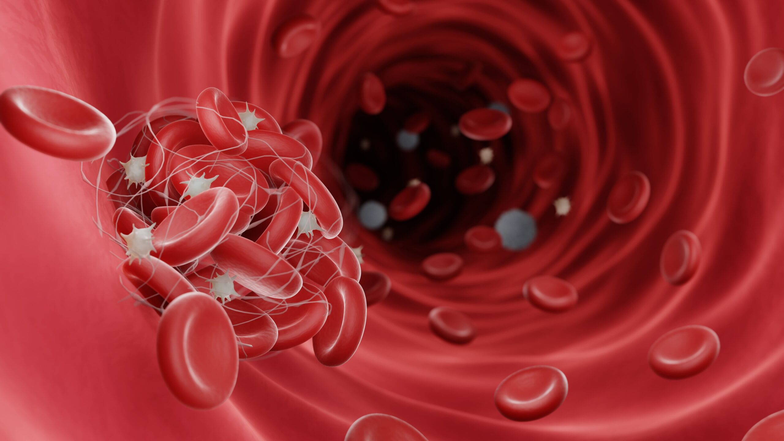 Fidanacogene Elaparvovec-dzkt Approved by FDA for Hemophilia B