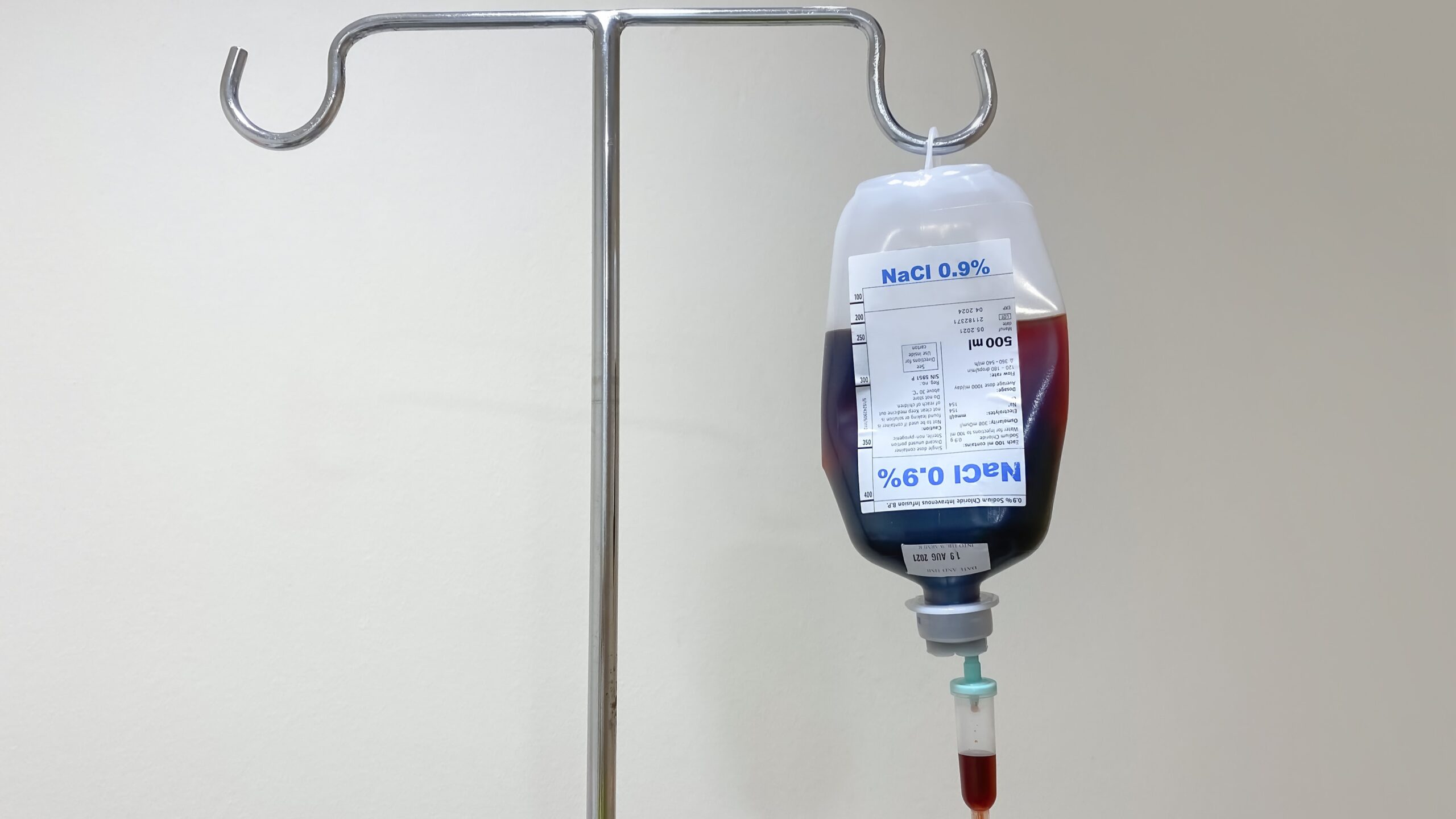 Intravenous Iron Therapy Appears Optimal in Iron Deficiency Anemia With IBD