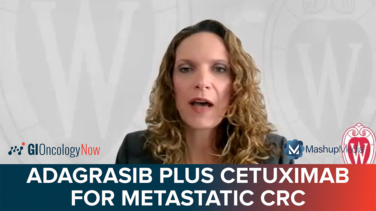 Utility of Adagrasib Plus Cetuximab in Patients with KRAS G12C-Mutated Metastatic CRC