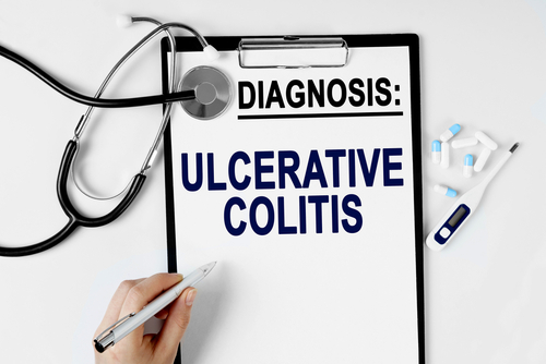 Continuation of JAK Inhibitor Therapy Prevents Relapse in Patients With Ulcerative Colitis