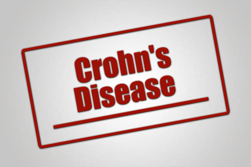 Study Reveals Key Genes Involved in the Dysregulation of Adipose Stem Cells in Crohn Disease