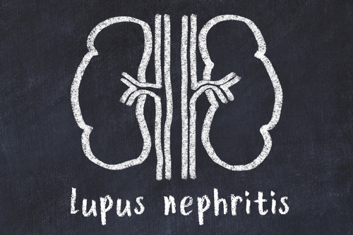 Optimal Glucocorticoid Dosing in Lupus Nephritis?