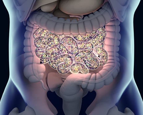 Evaluating the Incidence, Survival Outcomes of Gastrointestinal Stromal Tumors