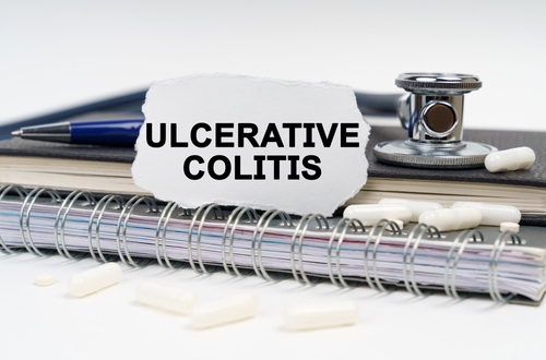 This Genetic Variant is Linked to Severe Ulcerative Colitis