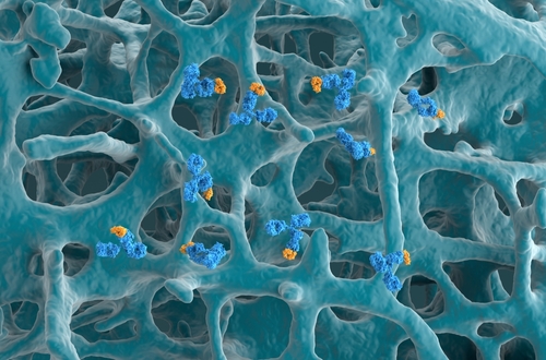 Potential Role of Monoclonal Antibodies in Asthma Structural Changes