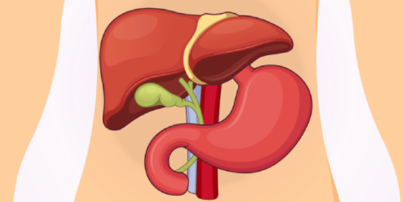 Pre-, Post-Biopsy Samples Show Significance of Tumor Budding Post-NAC for iCCA Patients