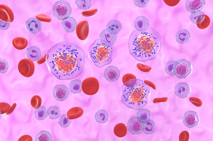 Study Shows No Clinical Benefit Observed With Atezolizumab as Adjunctive Therapy for Triple Negative Breast Cancer
