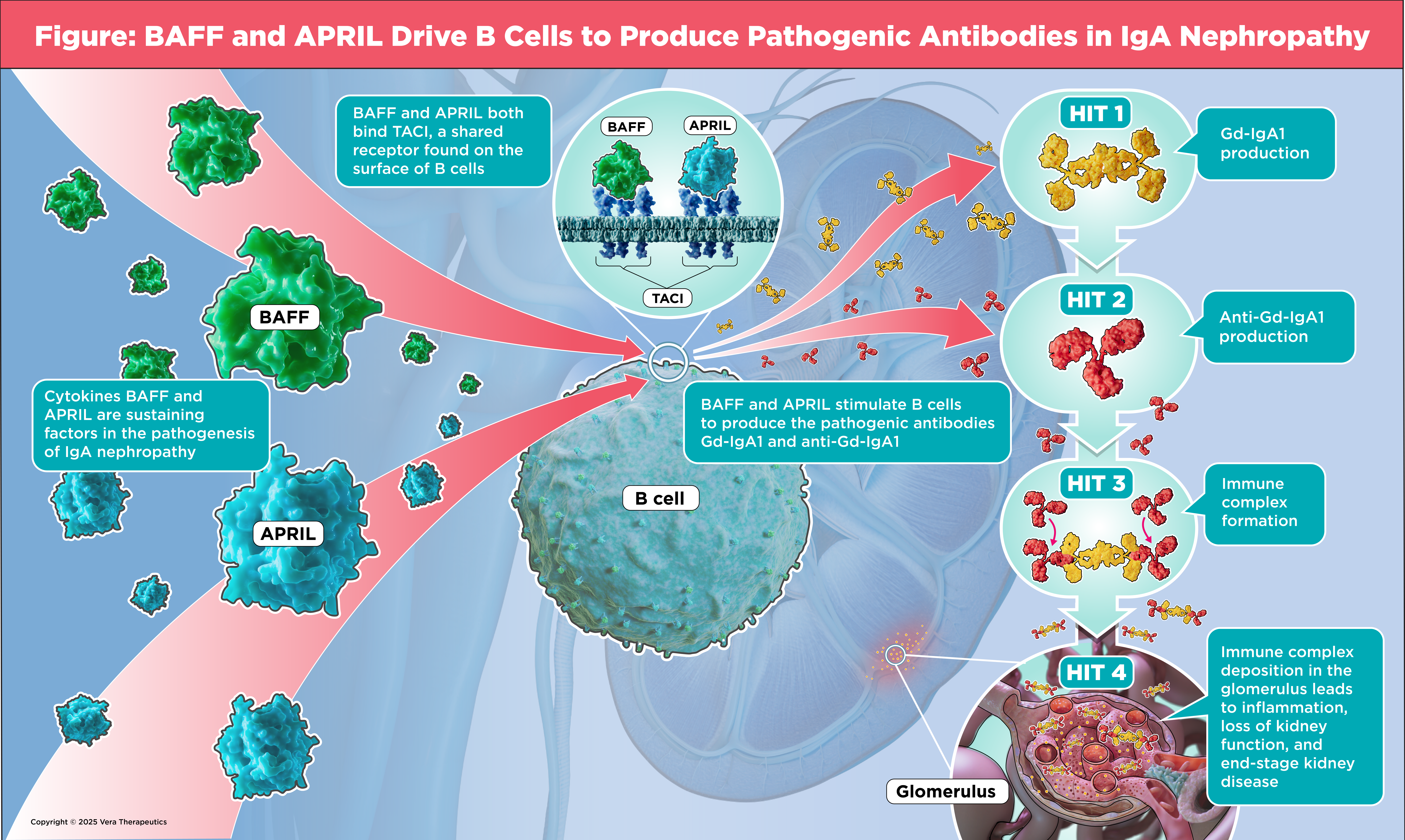 The Role of BAFF and APRIL in IgA Nephropathy