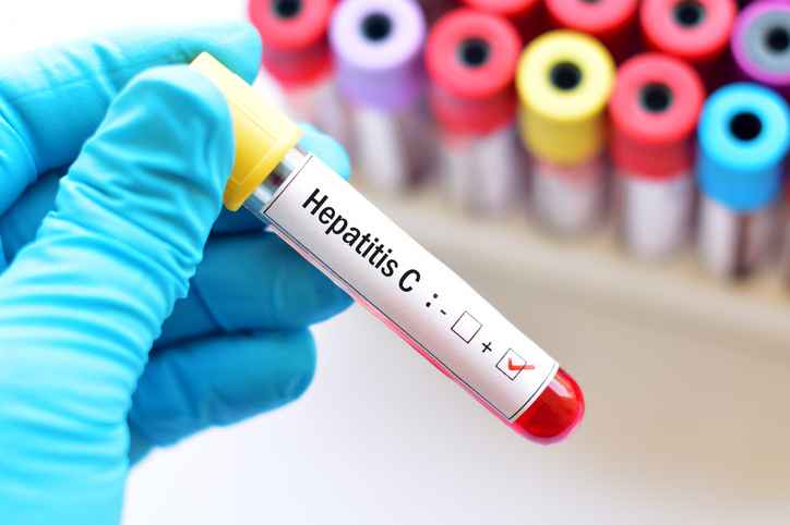 Hepatitis C and Sjögren’s Have Distinct Disease Profiles, Study Finds