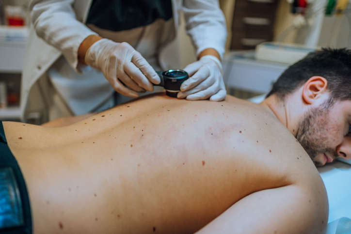 Gut Microbes and Gene Expression May Affect Responses to Targeted Therapy in Melanoma