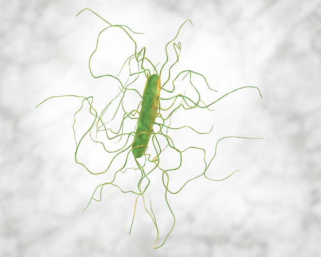 Early Colectomy After Infliximab in Ulcerative Colitis Linked to C ...