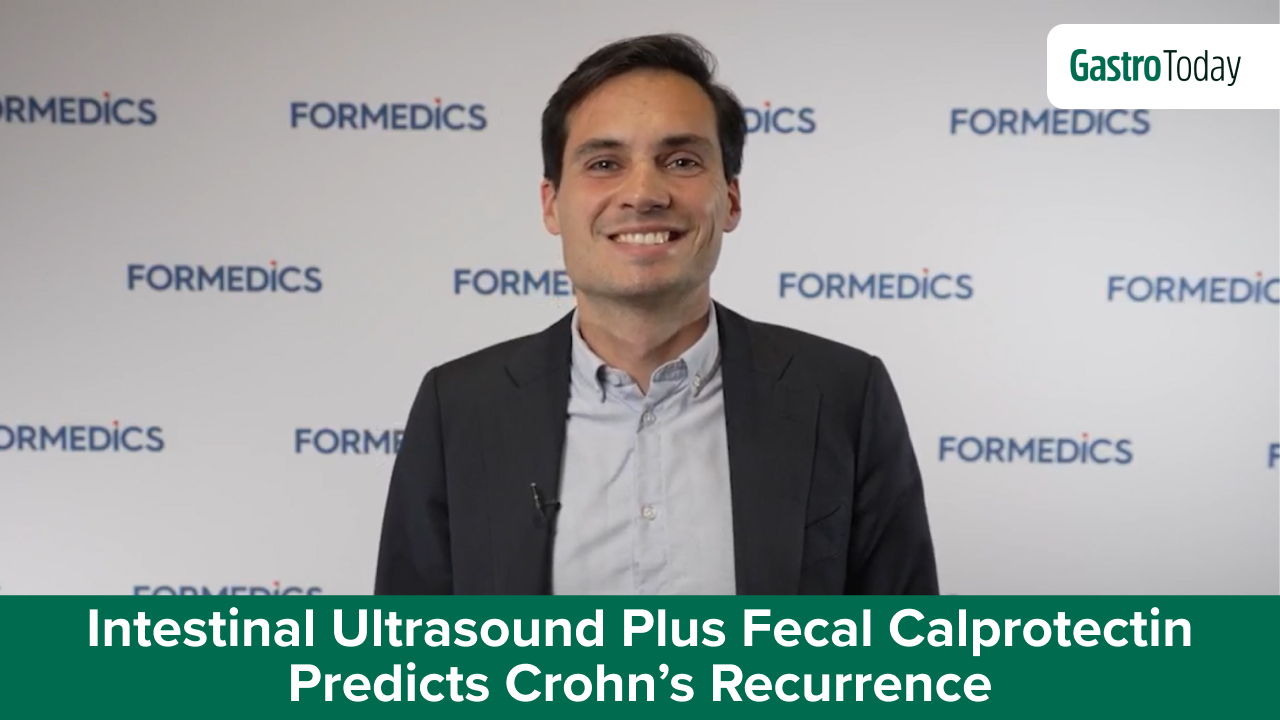 Intestinal Ultrasound Plus Fecal Calprotectin Predicts Crohn's Recurrence | Docwire News