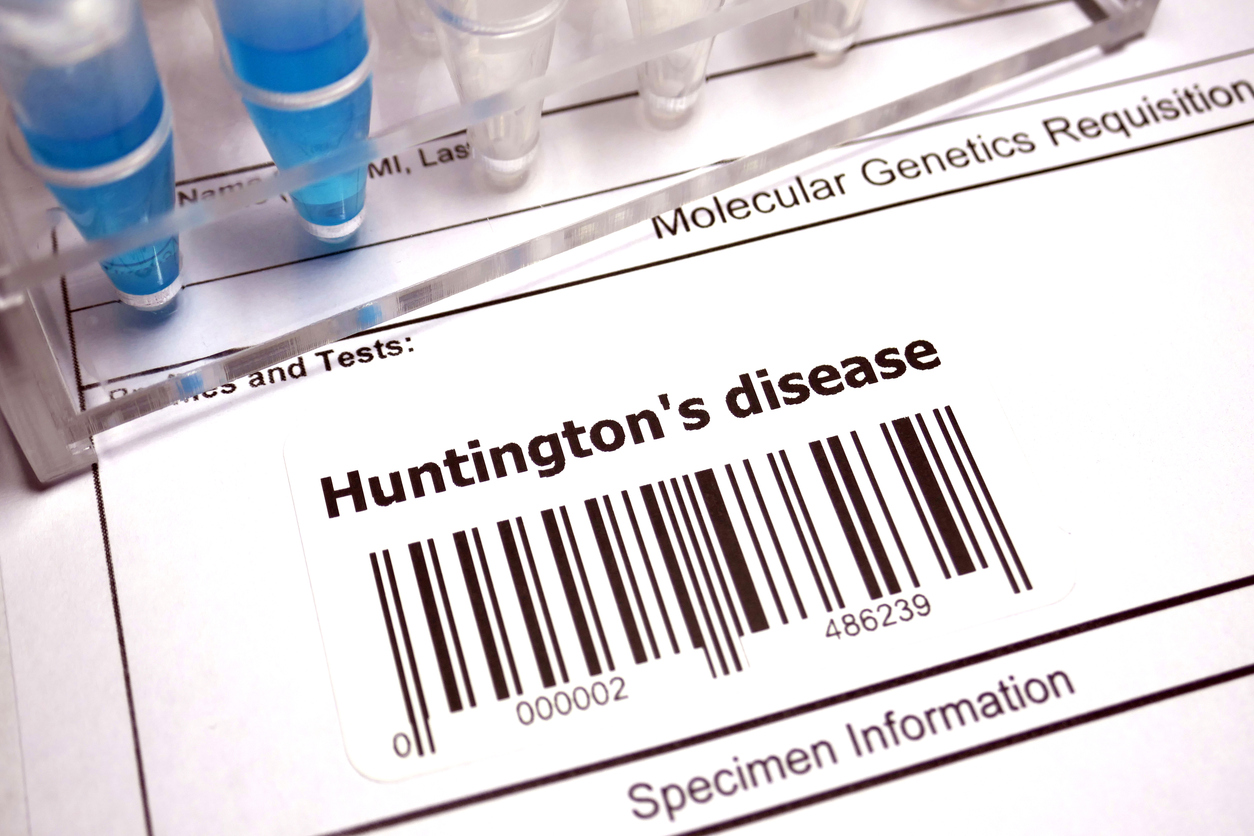 Patients With Huntington’s Disease Could Present With Parkinson-Like ...