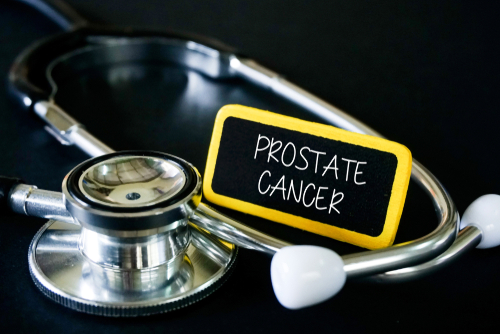 PSMA PET: An Important Tool for Prostate Cancer Treatment Planning