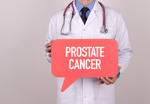 Assessing PSMA PET Uptake in Prostate Cancer Following Radiation