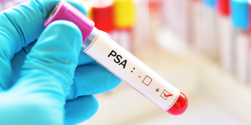 Enzalutamide Plus LuPSMA Offers Enhanced PSA-PFS in mCRPC