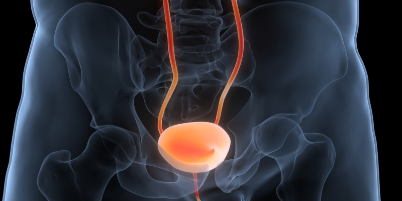 Predicting 90-Day Mortality After Radical Cystectomy for Bladder Cancer