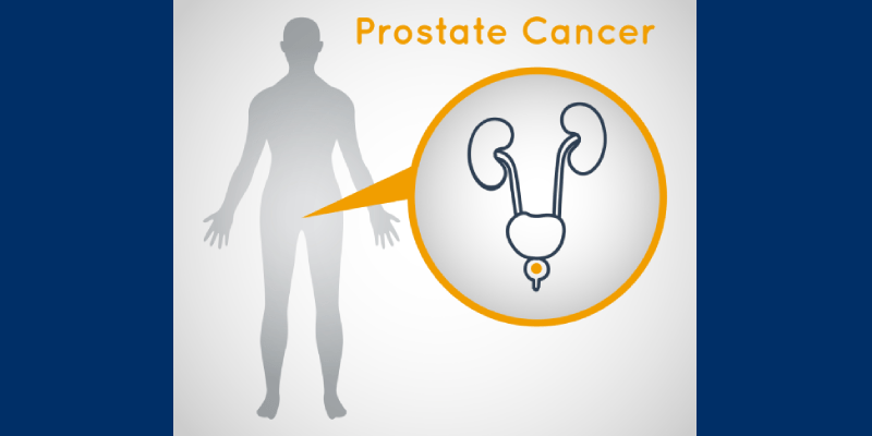 How Does Performance Status Affect the Efficacy of Systemic Therapy for Prostate Cancer?