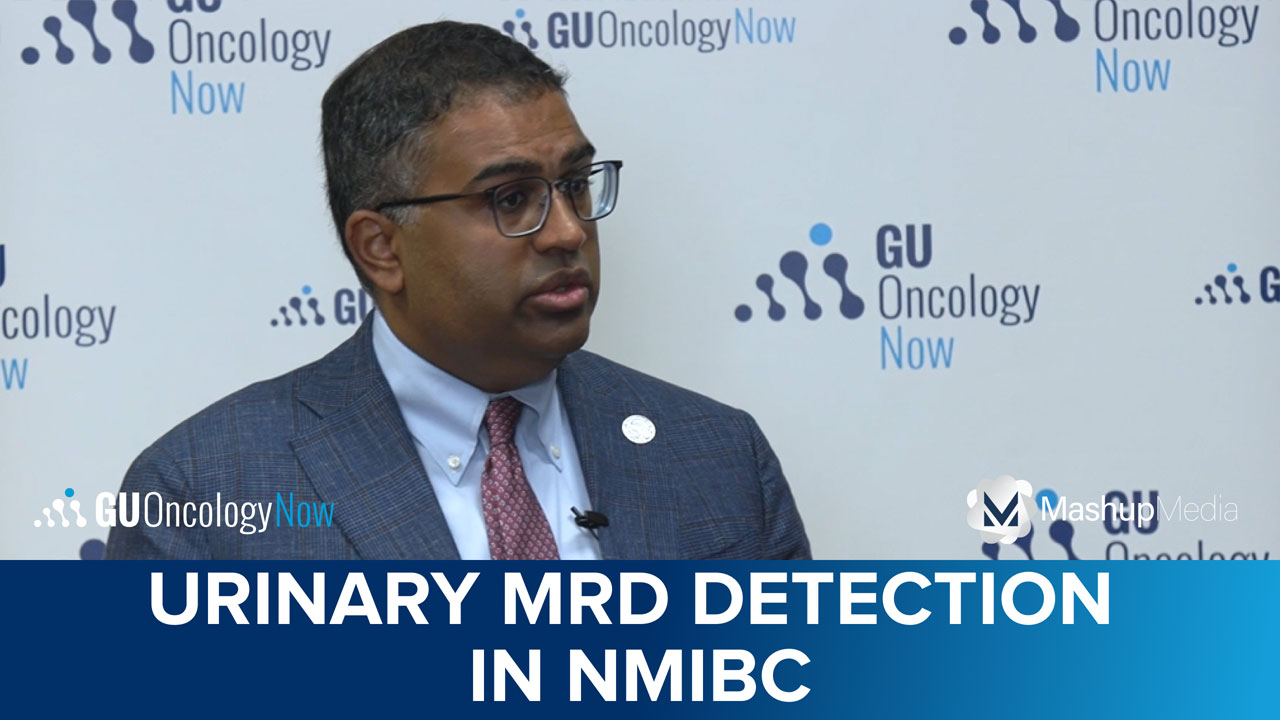 Urinary MRD Detection for Predicting Recurrence, Response to Nadofaragene Firadenovec in BCG-Unresponsive NMIBC