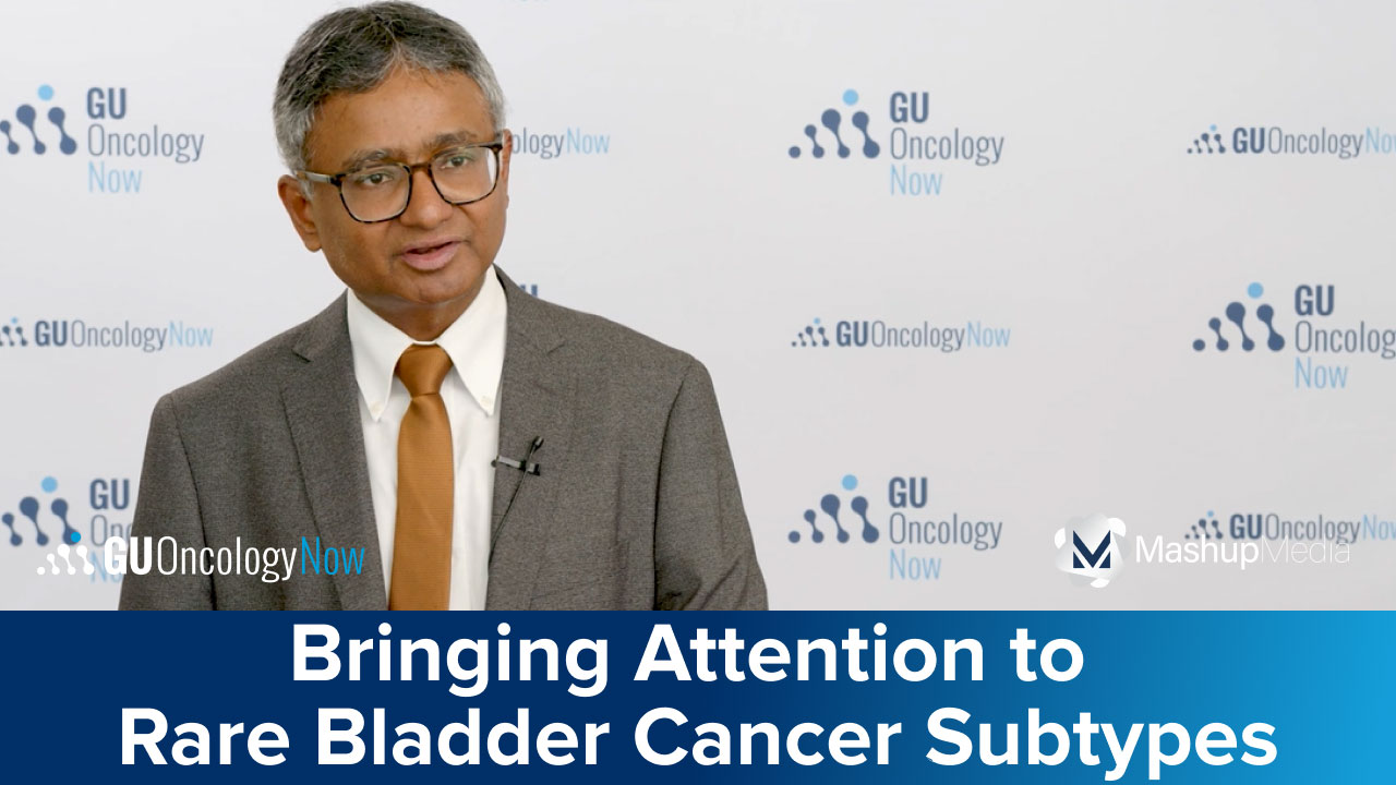 Putting the Spotlight on Rare Bladder Cancers With Dr. Syed Hussain