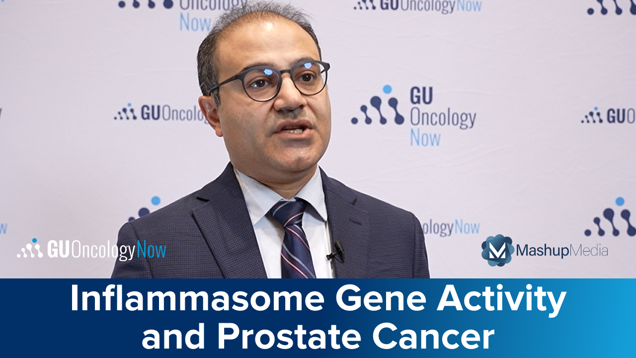 Investigating Inflammasome Gene Activity and Its Impact on Prostate Cancer Outcomes