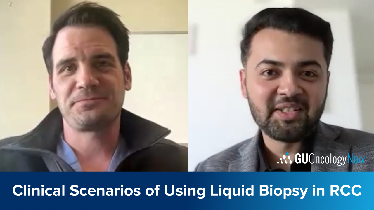 Using Liquid Biopsy in RCC: Practical Scenarios and Clinical Insight