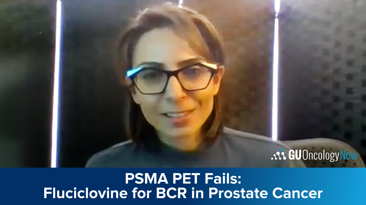 When PSMA PET/CT Is Negative: Using 18F-Fluciclovine in Biochemical Recurrence of Prostate Cancer