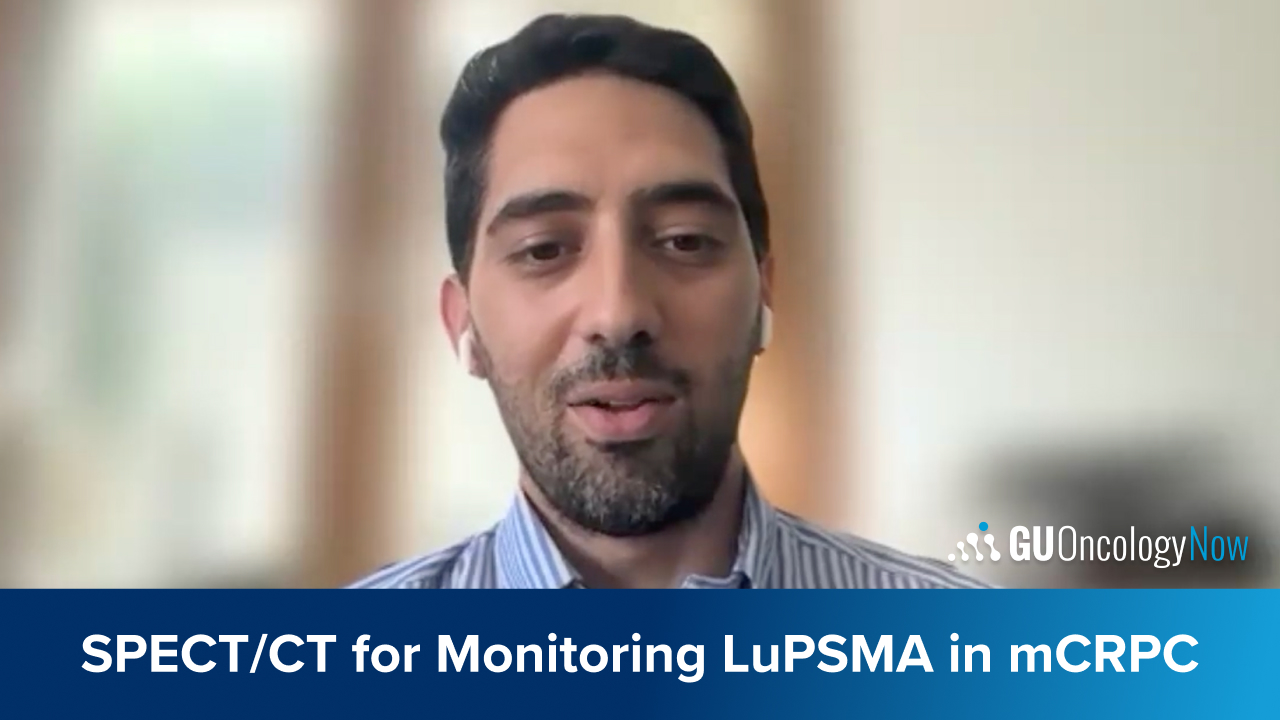 Prognostic Value of LuPSMA-SPECT/CT: Developing Clinical Protocols for Monitoring mCRPC Therapy