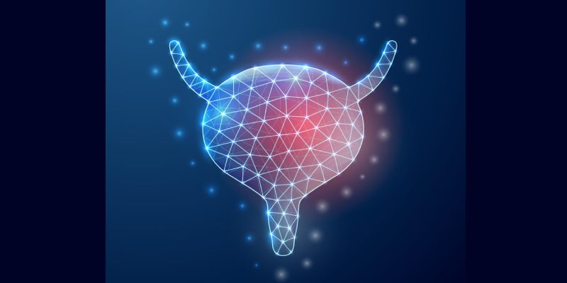 Deep Learning Model Effectively Compares Clinical Outcomes of Patients With NMIBC Undergoing BCG Therapy