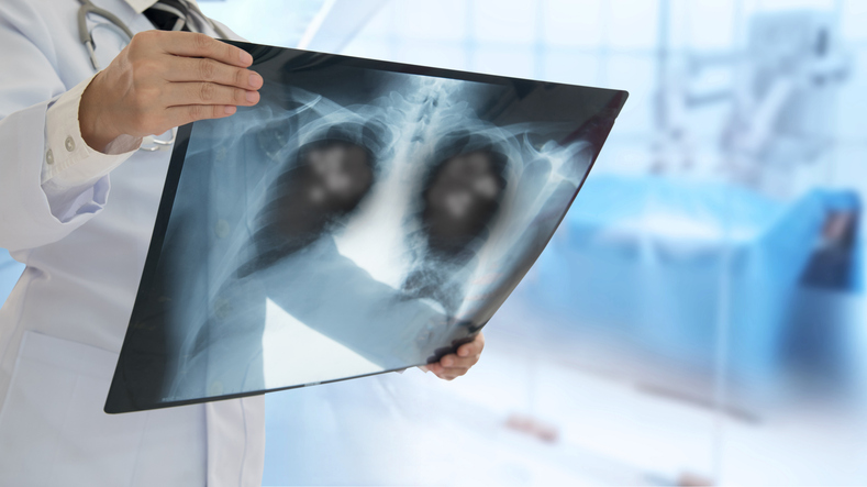 SACHI: Savolitinib Plus Osimertinib Prolongs PFS Versus Chemotherapy in MET-Driven EGFR-Mutated NSCLC