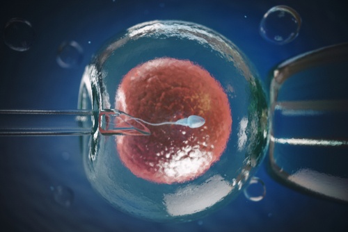 New AI Fertility Product to Lower Cost and Improve IVF Treatment Outcomes