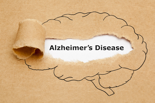 Scientists Find Clue Explaining Why Alzheimer's Disease More Prevalent in Women