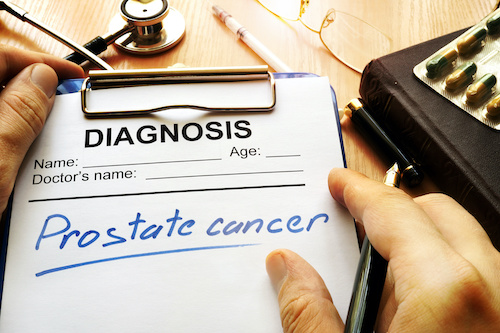 Misconception About the Link Between Prostate Cancer & Urinary Symptoms May Lead to Later Diagnosis