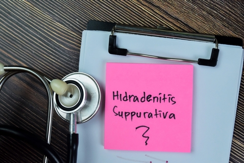 People of Color With Hidradenitis Suppurativa Have Worse Disease Severity