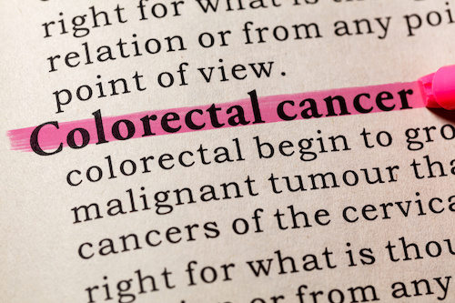 Black Patients with Early Colorectal Cancer Receive Worse, Delayed Care