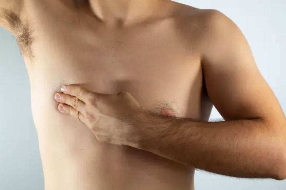 Male Breast Cancer Patients Face Death Risk at 20 Years