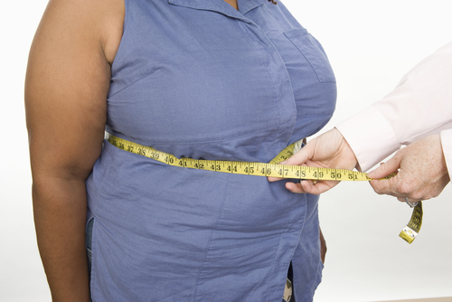 Black Women With Obesity Face a Higher Risk of Early-Onset Breast Cancer