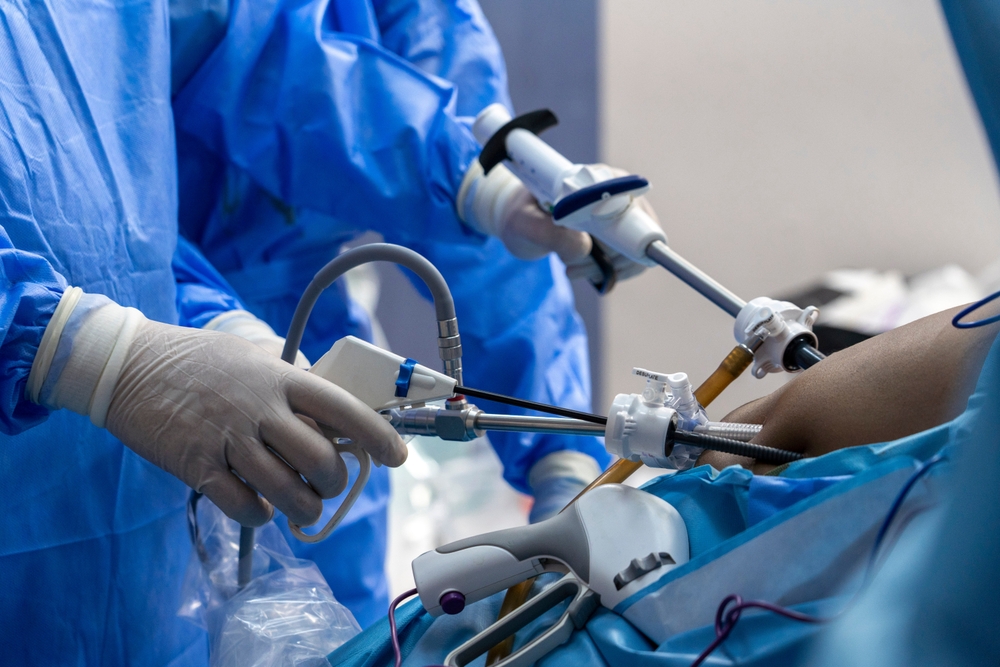 Laparoscopic Surgery Proves Non-Inferior to Open Surgery in Obese Colon Cancer Patients