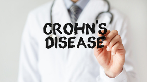 Minorities Are Underrepresented in the Major Biologics Trials for Crohn Disease