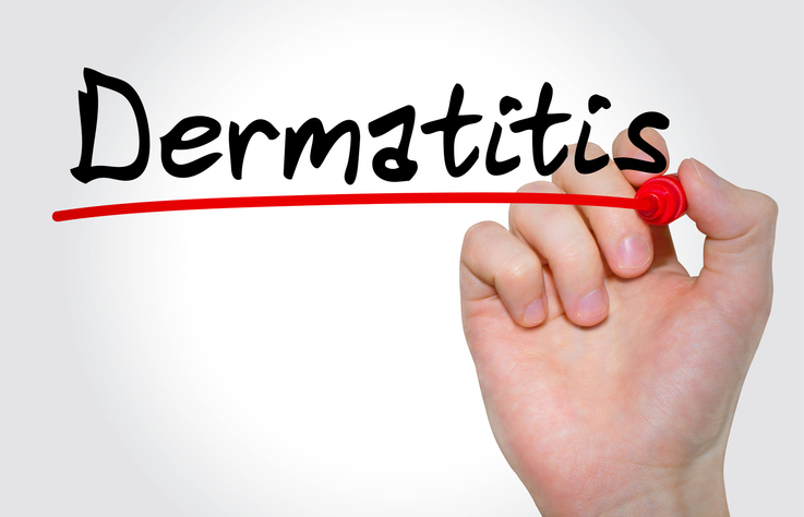 Racial, Ethnic Disparities Impede Access to Atopic Dermatitis Treatment