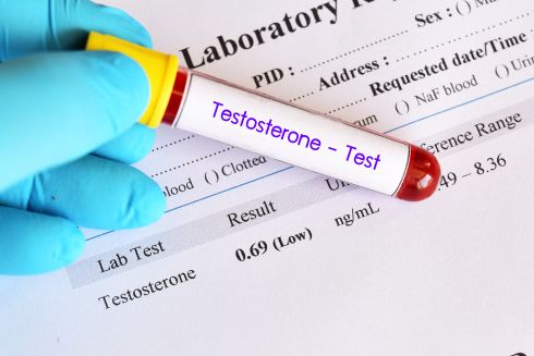 Low Testosterone and Sleep Deprivation Linked to Psoriasis Risk in Men